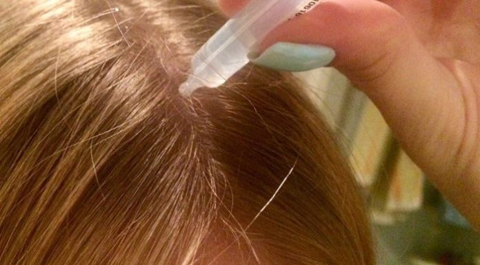 Лікарка-трихолог розповіла про вплив нікотинової кислоти на волосся