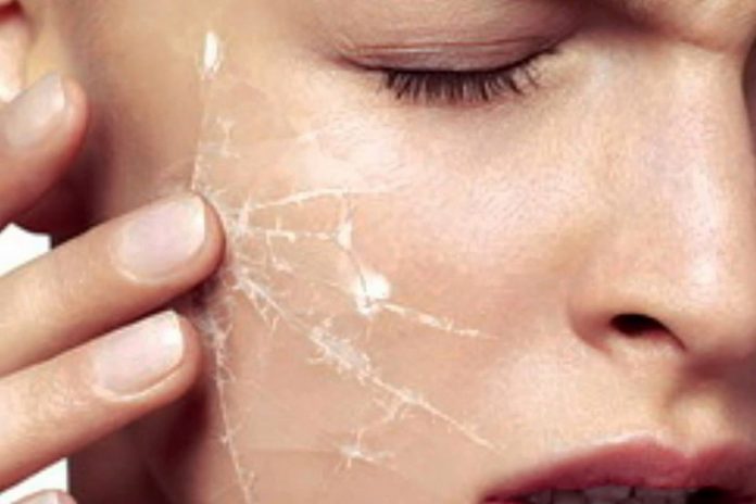 Чому шкіра обличчя може стати чутливою і як за нею доглядати