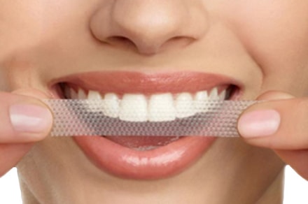 Сліпуча посмішка: 5 найпопулярніших способів відбілити зуби